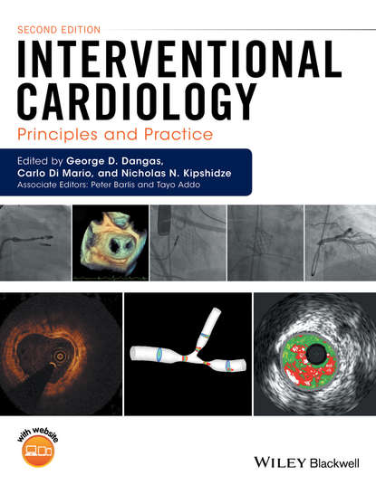 Interventional Cardiology. Principles and Practice