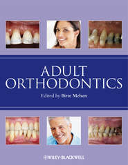 Adult Orthodontics