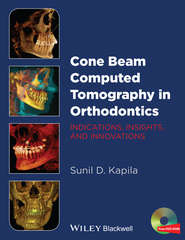 Cone Beam Computed Tomography in Orthodontics. Indications, Insights, and Innovations