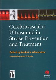 Cerebrovascular Ultrasound in Stroke Prevention and Treatment