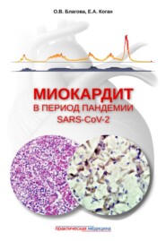 Миокардит в период пандемии SARS-CoV-2