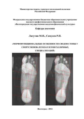 Морфофункциональные особенности сводов стопы у спортсменов-легкоатлетов различных специализаций